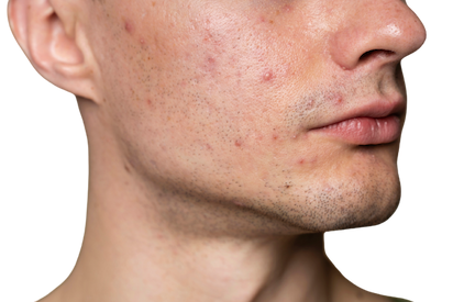Pores On Skin